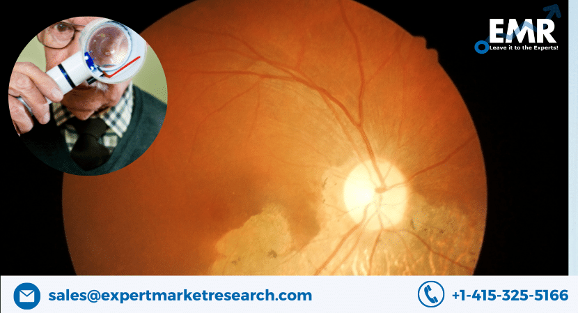 Global Age-Related Macular Degeneration (AMD) Market Size To Grow At A CAGR Of 8.93% In The Forecast Period Of 2023-2028