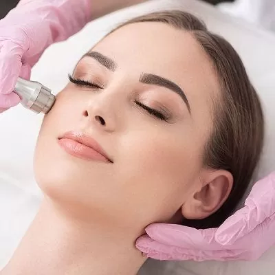 Improve Your Skin’s Health with Microneedling Treatment for Anti-Acne Treatment in Calgary